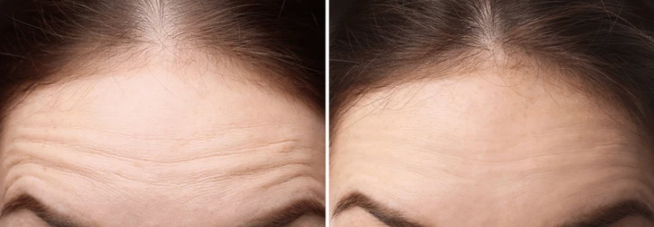 Lineas de expresion